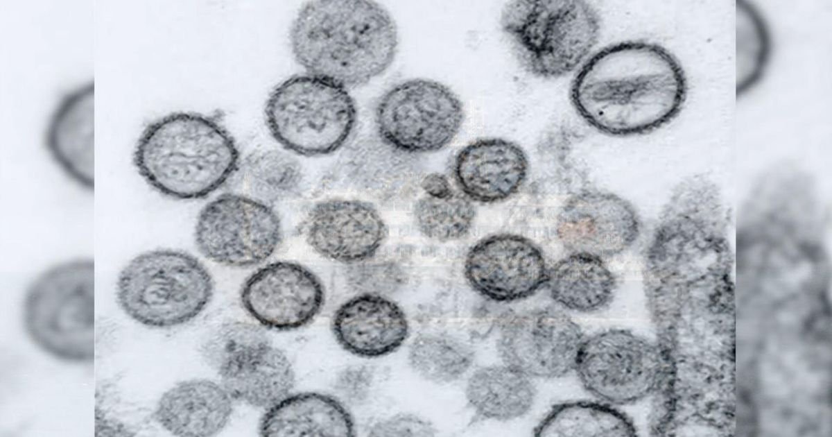 Hantavirus dan COVID: Ketakutan serupa, perbedaan besar :: WRAL.com

